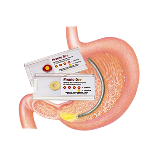 Pronto Dry Helicobacter pylori Test 10 Stk.