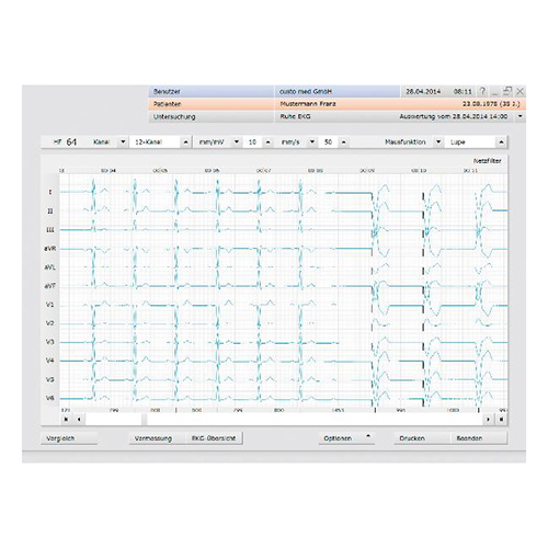 CUSTO MED cardio professional Software Ruhe-EKG Software
