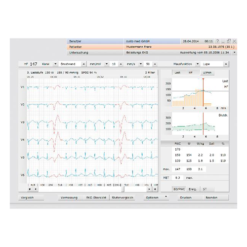 CUSTO MED Ergometrie standard Software Software zu Belastungs-EKG